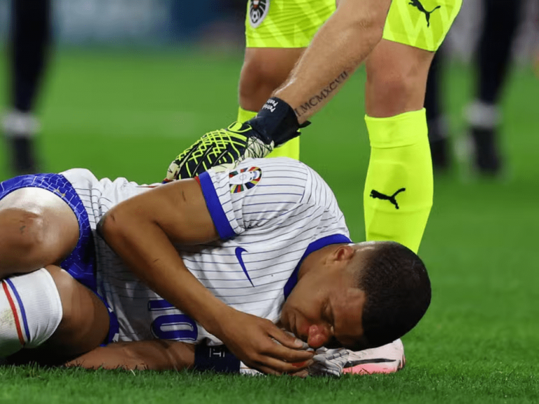 Mbappé fraturou o nariz na vitória da França contra a Áustria